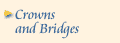 Crowns and Bridges