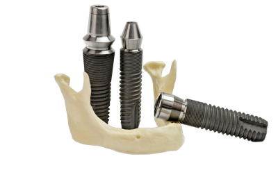 Los Angeles Dental Implants