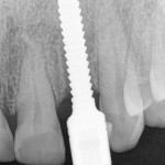 a13-150x150