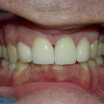b2 (1)