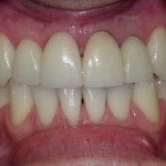 b21-150x150