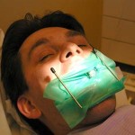 Canal-Dentist-Los-Angeles