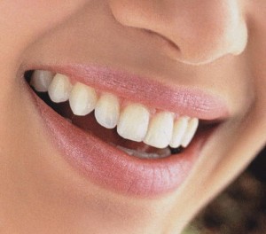 co-smile-2-300x264