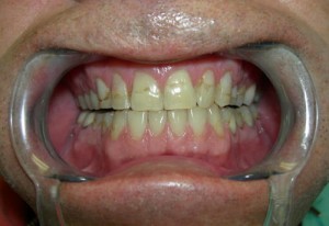 Los-Angeles-Cosmetic-Dentist-300x206