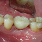 Dental-Implant-Dentist-150x150