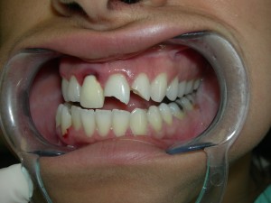 Dental-Pain-300x225