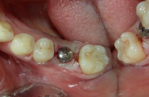 Dentist1-300x196