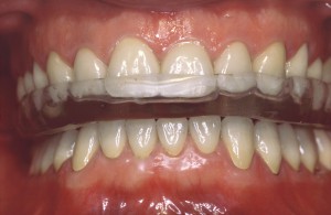 Los-Angeles-Cosmetic-Dentistry-300x195