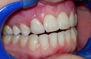Cosmetic-Dentistry-300x196 (1)
