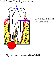 instrumentation visit