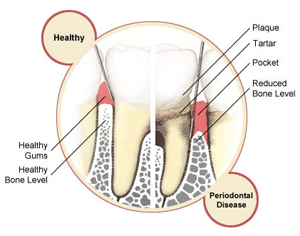 Periodontal Health1 (1)