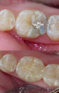 Cosmetic Dentistry