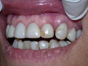 Cosmetic Dentistry