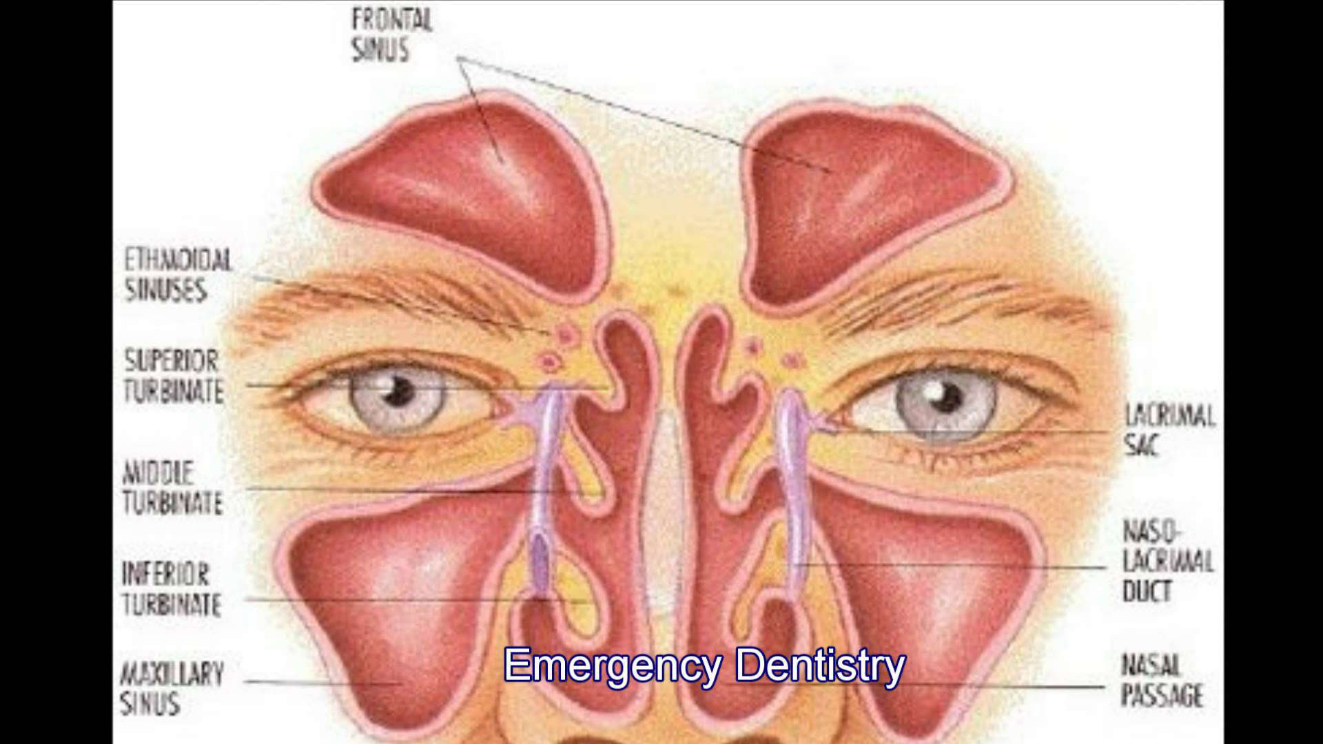 sinus canal infection