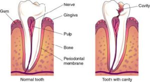 Emergency Dentist