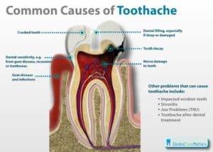 Tooth-Ache-300x214.jpg