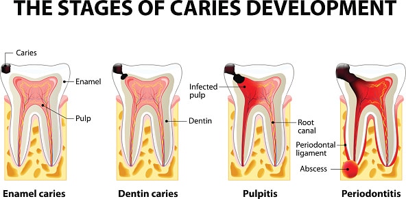 Emergency Dentist Los Angeles